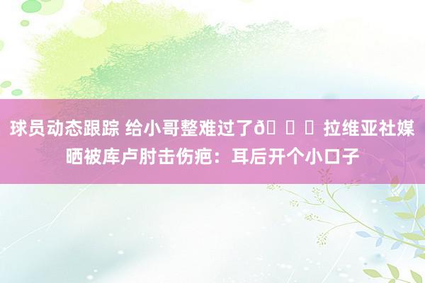 球员动态跟踪 给小哥整难过了😅拉维亚社媒晒被库卢肘击伤疤：耳后开个小口子